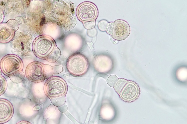 Mycogone spores